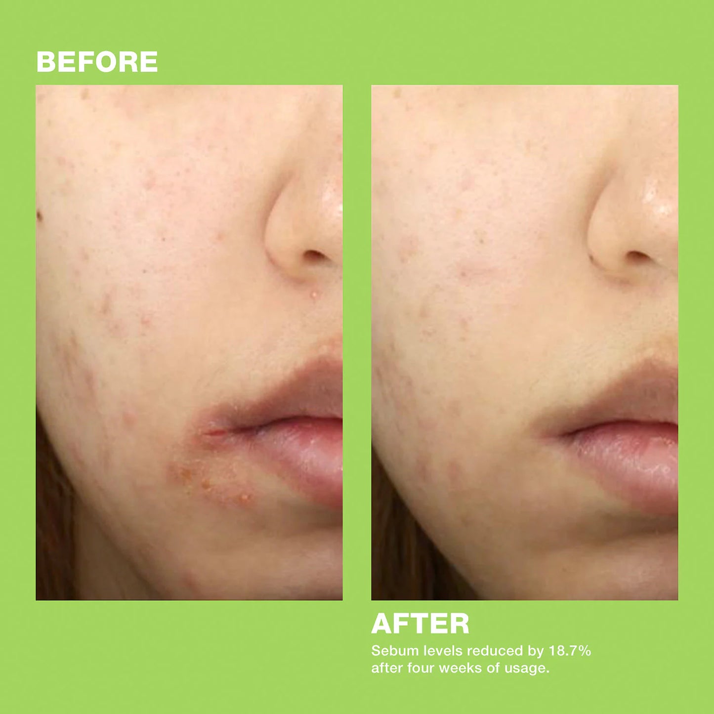 Dr. Jart+ Ctrl+A Teatreement Moisturizer